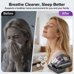 North Collective Huisstofmijt Stofzuiger - Tapijt Reiniger - Bank, Bed & Matras Reiniger - 350 W 24kPa Zuigkracht - Hete Lucht & Droger - Bacterie, Mijt & Schimmel Bestrijder — thumbnail 5