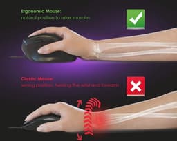Ergonomische Verticale Muismouse met 3200 DPI en Gewichtsaanpassing — thumbnail 5