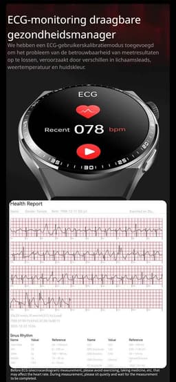 DrPhone ChronaX4 Smartwatch – ECG, Bloedglucose, SpO2, Urinezuur, Lichaamssamenstelling, Bluetooth Bellen, 158 Sportmodi, Slaap & HRV, IP67 – Zwart — thumbnail 3